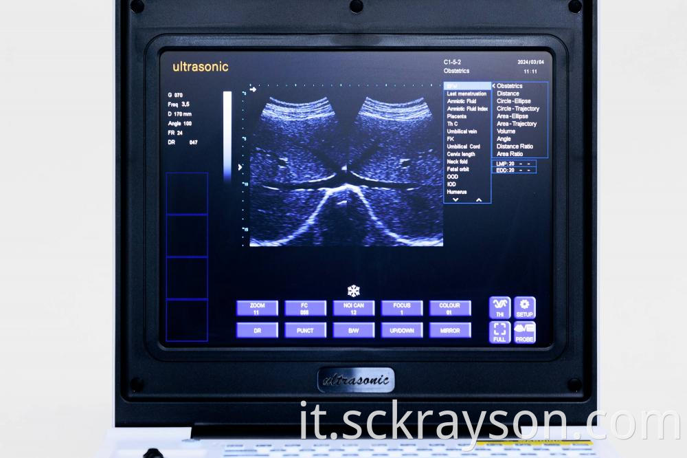 Laptop Ultrasound Screen 2